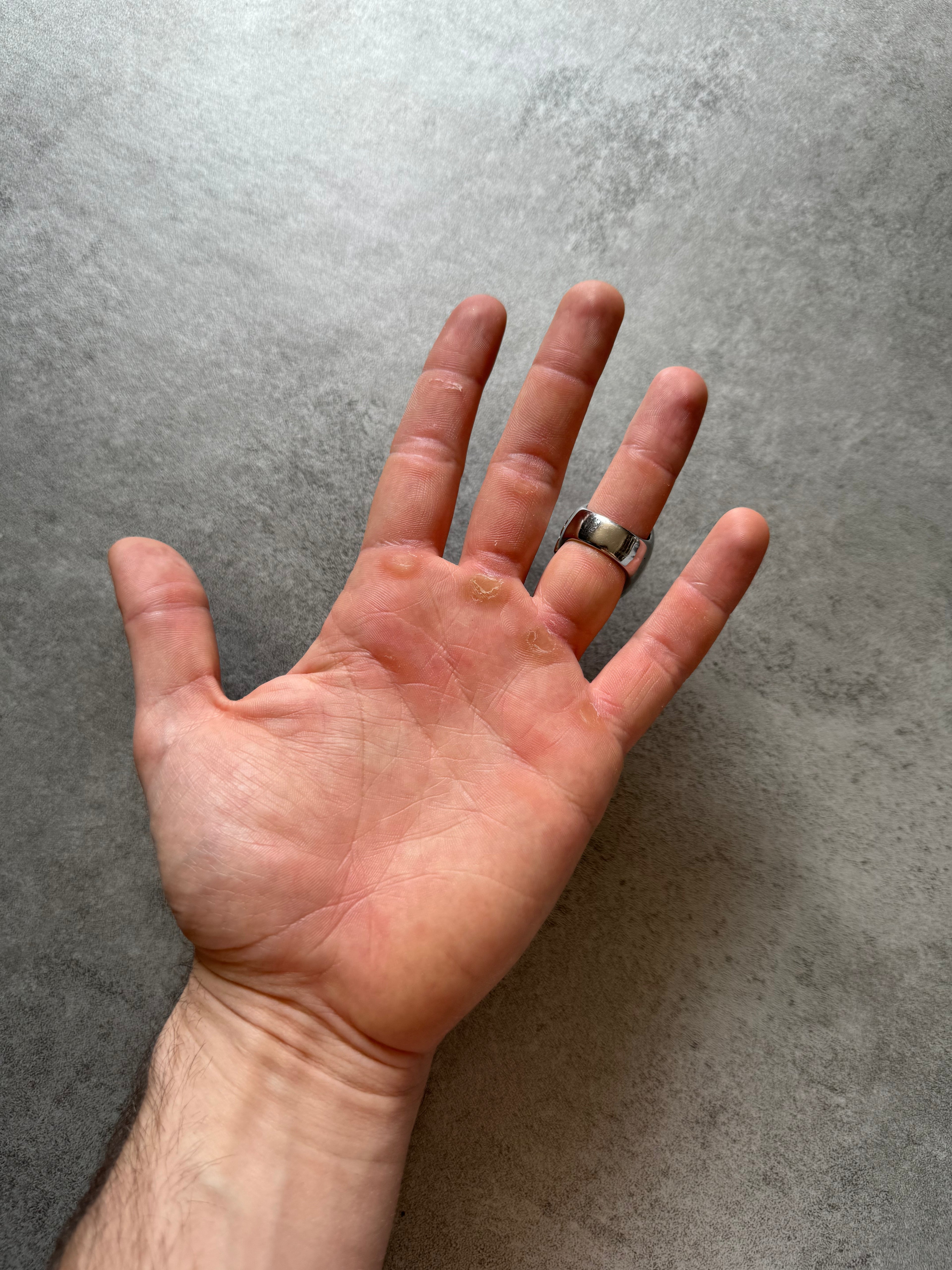 Dolce & Gabbana Marble Power Ring (OS) - 2